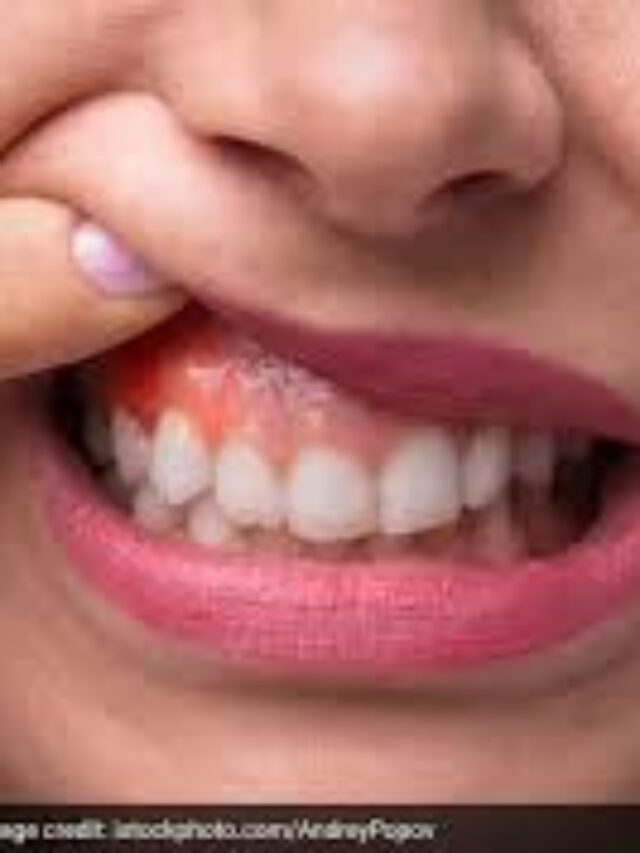 Can You Get Oral Cancer Without Tobacco Experts Reveal Warning Signs and When to Get Tested