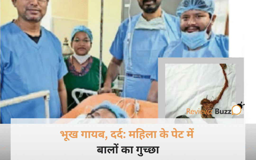 महिला के पेट में बालों का गुच्छा और डॉक्टर की चौंकाने वाली मेडिकल रिपोर्ट