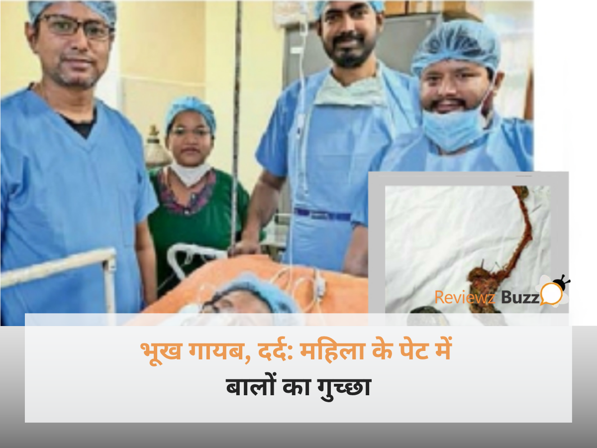 महिला के पेट में बालों का गुच्छा और डॉक्टर की चौंकाने वाली मेडिकल रिपोर्ट